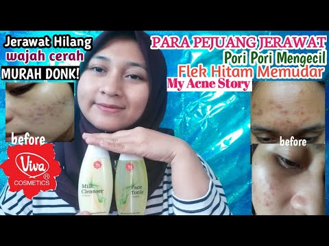 download lagu mp3 mp4 Cara Menghilangkan Komedo Dengan Viva, download lagu Cara Menghilangkan Komedo Dengan Viva gratis, unduh video klip Cara Menghilangkan Komedo Dengan Viva