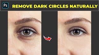 How to Remove Eye Bags Without Losing Any Texture - Photoshop Tutorial