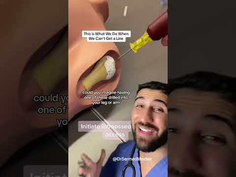 This is What We Do When We Can’t Get a Line #emergency