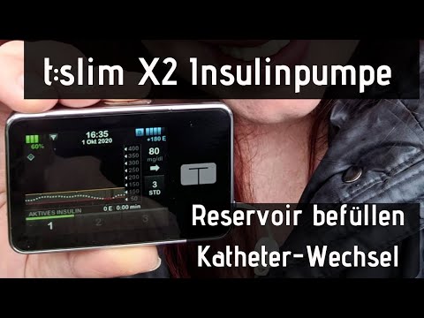 t:slim X2 Insulinpumpe - Reservoir befüllen / Katheter-Wechsel in Echtzeit!