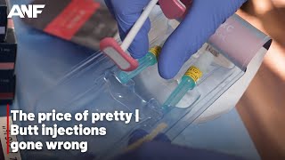 The price of pretty: Butt injections gone wrong