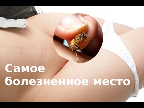7 позвоночник грудного отдела Прогибы и раскрытие грудного отдела