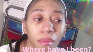 Where have I been?/ Life Update/ Ectopic Pregnancy