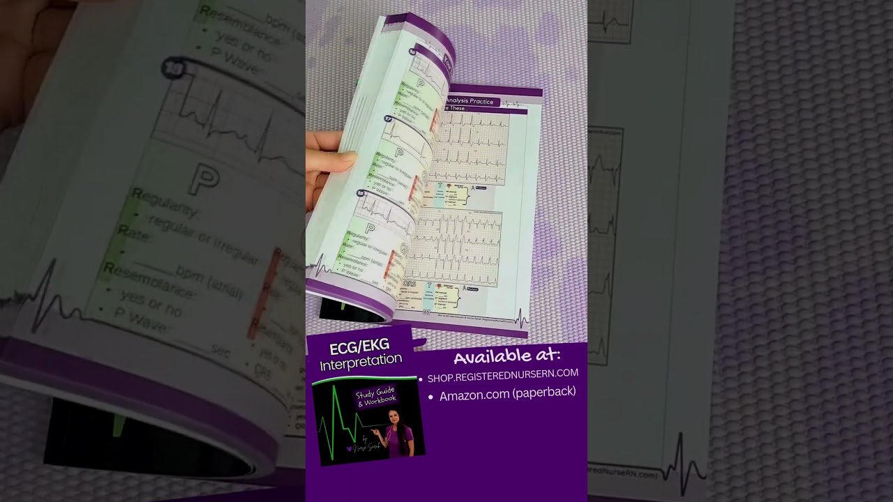 ECG Interpretation Study Guide by Nurse Sarah