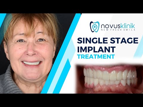 Logo of Transform Your Smile with Affordable Dental Implants in Istanbul, Turkey – How It Works