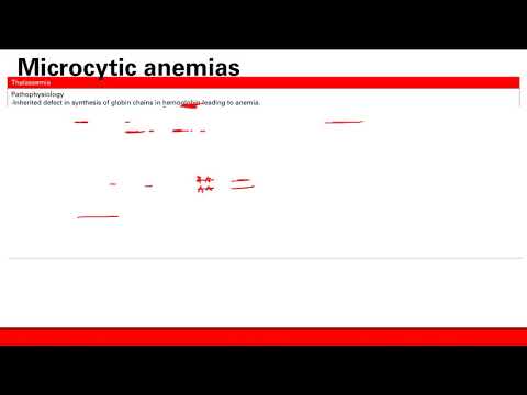 Microcytic anemia  | Hematology | Step 1 Simplified
