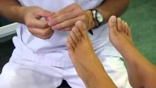 Ejemplos de ortesis de silicona