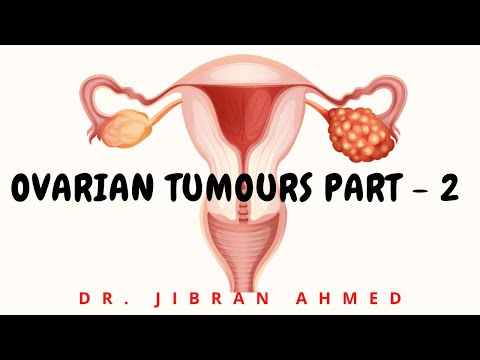 ENDOMETRIAL CARCINOMA II FEMALE GENITAL TRACT II ROBBINS 10TH E II PATHOLOGY LECTURE