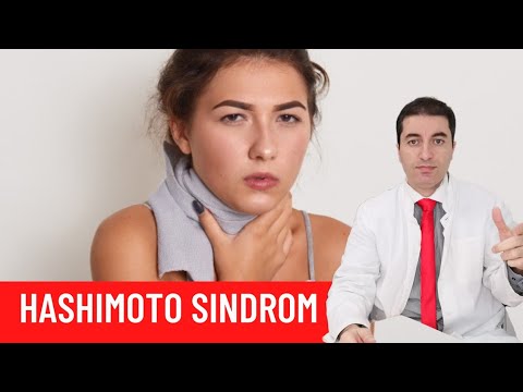 HASHIMOTO SINDROM (bolest štitnjače) - što morate znati?