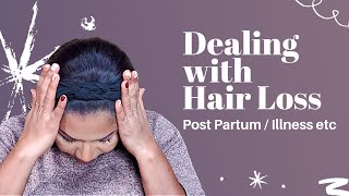 Dealing with My Hair Loss |Post Partum & Illness |Sheri Approved