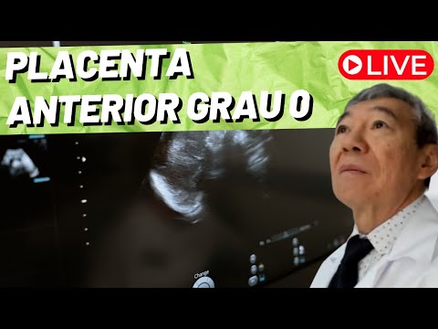 AO VIVO: PLACENTA ANTERIOR GRAU O!