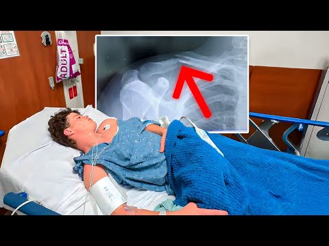 I Broke My Collarbone…