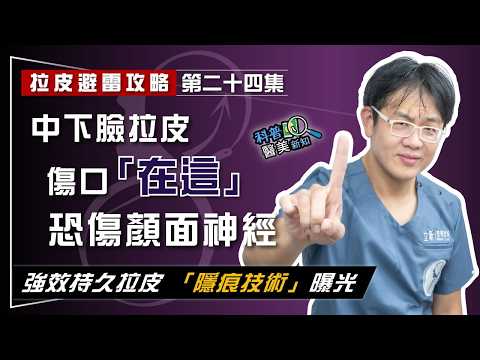 【拉皮避雷攻略|第二十四集】中下臉拉皮手術傷口位置「在這」恐出大事! 易傷顏面神經、留醜疤
