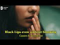 3 Reason why Lips are getting black even without smoking|Solution-Dr.Rashmi Ravinder|Doctors' Circle