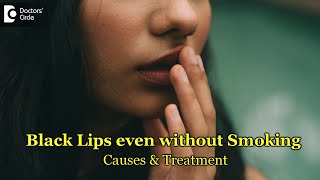 3 Reason why Lips are getting black even without smoking|Solution-Dr.Rashmi Ravinder|Doctors