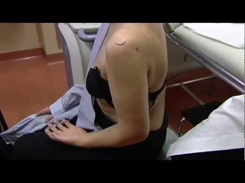 Meteozavisimost e mal di schiena Trattamento corsetto osteocondrosi cervicale