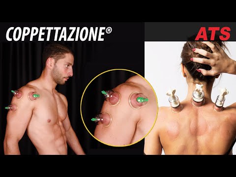 La potenza delle antiche ricette Massaggio trattamento dellimpotenza