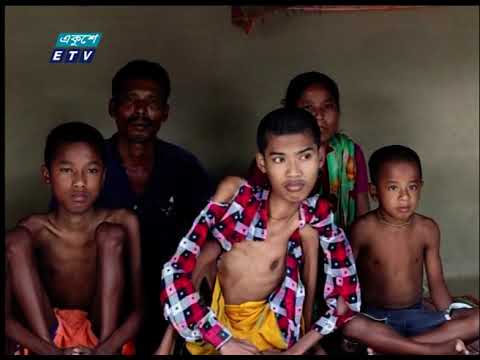 বিরল রোগে আক্রান্ত একই পরিবারের তিন সন্তান