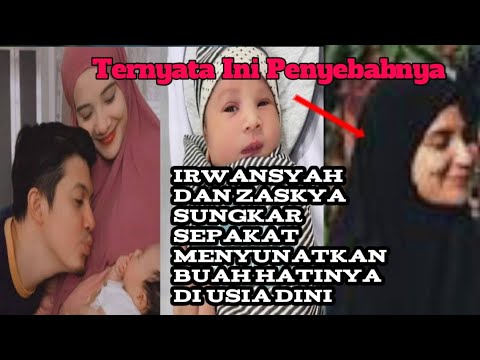 Di usia22 hari ternyata anak Irwansyah dan Zaskia Sungkar sudah di sunat