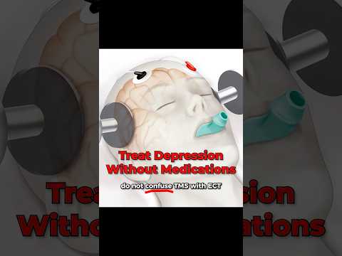 Is TMS For Depression Electroshock Therapy? | Los Angeles | Neopsych.com