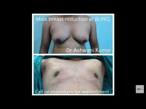 Patient Recovery Case — Video 8 (Clinical Testimonial)