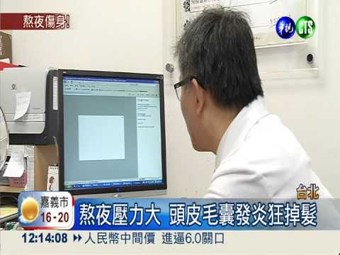 拚年終常熬夜 小心疱疹.頭皮發炎