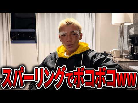 【笑撃】亀田京之介が非ボクサーにスパーリングでボコボコにされるww