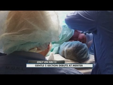 Gentle C-Sections 10pm 08/06/2015