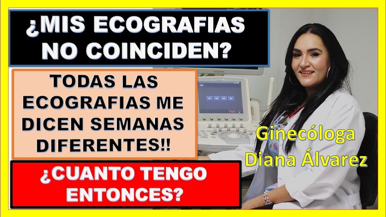 MI ECOGRAFIA NO COINCIDE CON MIS SEMANAS DE GESTACIÓN, POR GINECOLOGA DIANA ALVAREZ
