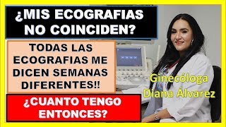 MI ECOGRAFIA NO COINCIDE CON MIS SEMANAS DE GESTACIÓN, POR GINECOLOGA DIANA ALVAREZ