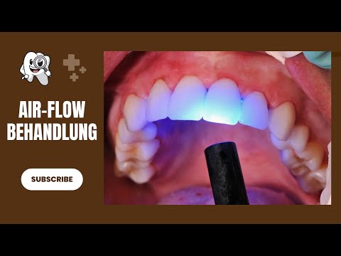 Air-Flow Dental Behandlung, die die Kunden WIRKLICH wünschen! | Zahnklinik-Ungarn.de