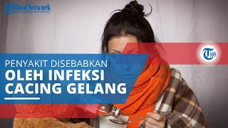 Askariasis, Infeksi Cacing Gelang yang Masuk ke Tubuh dan Sebabkan Berbagai Masalah Kesehatan