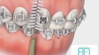 Ara yüz fırçası nasıl kullanılır 