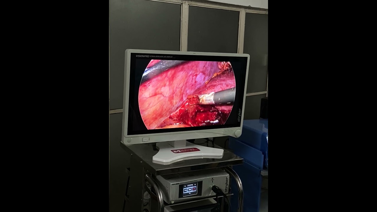 Stryker 1588 Optical Clarity Trace