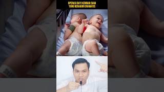 Download lagu OPERASI PEMISAHAN BAYI KEMBAR SIAM YANG BERAKHIR DRAMATIS‼️#shorts #alurcerita #storytelling mp3