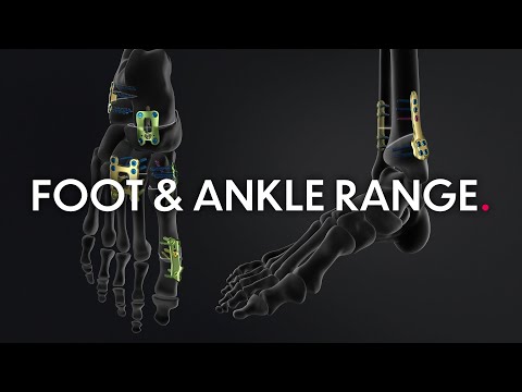 Foot & Ankle range - Solutions by Newclip Technics