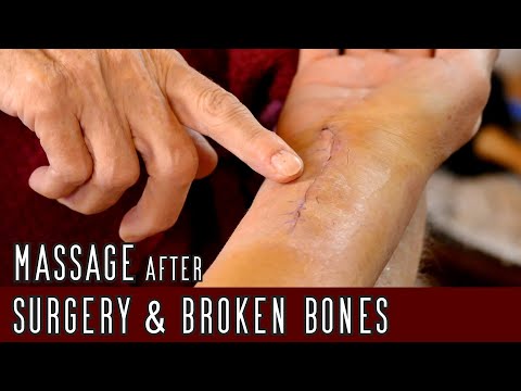 Massage After Surgery to Prevent Scarring, Post-Op Techniques for Swelling, Bruises, Scars | Athena