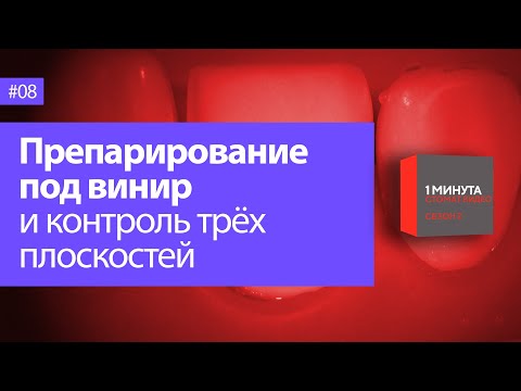 Препарирование под винир и контроль трёх плоскостей