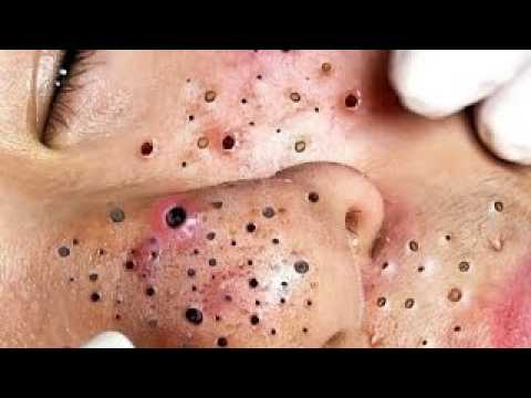 𝑺𝒐𝒐𝒕𝒉𝒊𝒏𝒈 𝑭𝒂𝒄𝒊𝒂𝒍 𝑻𝒓𝒆𝒂𝒕𝒎𝒆𝒏𝒕 𝑭𝒐𝒓 𝑺𝒕𝒓𝒆𝒔𝒔 𝑹𝒆𝒍𝒊𝒆𝒇 𝒂𝒕 𝑳𝒖𝒙𝒖𝒓𝒚 𝑺𝒑𝒂 𝑨𝒄𝒉𝒊𝒆𝒗𝒆 𝑰𝒏𝒏𝒆𝒓 𝑷𝒆𝒂𝒄𝒆 #500394