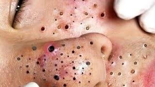 𝑺𝒐𝒐𝒕𝒉𝒊𝒏𝒈 𝑭𝒂𝒄𝒊𝒂𝒍 𝑻𝒓𝒆𝒂𝒕𝒎𝒆𝒏𝒕 𝑭𝒐𝒓 𝑺𝒕𝒓𝒆𝒔𝒔 𝑹𝒆𝒍𝒊𝒆𝒇 𝒂𝒕 𝑳𝒖𝒙𝒖𝒓𝒚 𝑺𝒑𝒂 𝑨𝒄𝒉𝒊𝒆𝒗𝒆 𝑰𝒏𝒏𝒆𝒓 𝑷𝒆𝒂𝒄𝒆 #500394