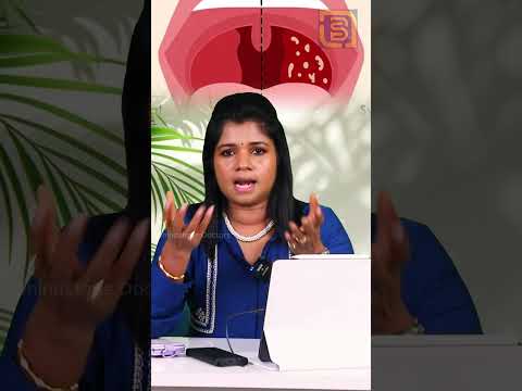 தொண்டையில் சதை வீக்கம் இருக்கா? #trending #youtubeshorts #tonsil #health #tips #tamil #behindstone