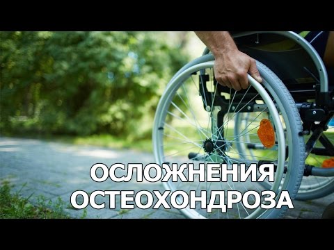 Какие упражнения нужно делать для шейного остеохондроза Гиалуроновая кислота уколы в коленный сустав отзывы цена