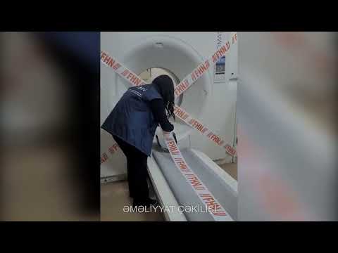 Tibb müəssisəsində rentgen kabinetinin fəaliyyəti çatışmazlıqlarla bağlı dayandırılıb