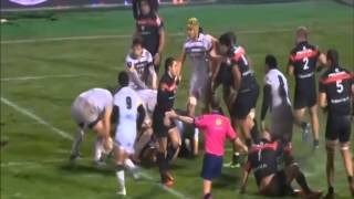 Example of ataxia following concussion