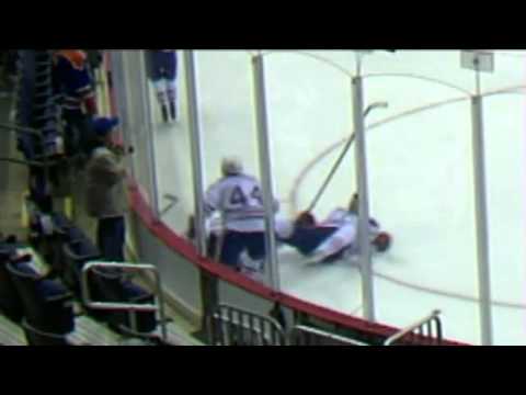 Taylor Hall is cut in the face by a skate in the warm up.