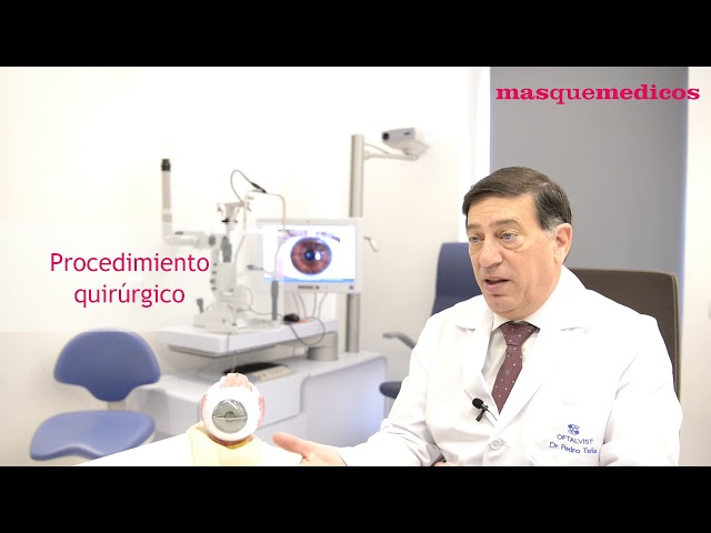 ¿Cómo se realiza la cirugía refractiva en Oftalvist? - Pedro Tañá Rivero