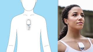 Instructions - How to apply the ePatch® - Philips Extended Wear Holter Monitor