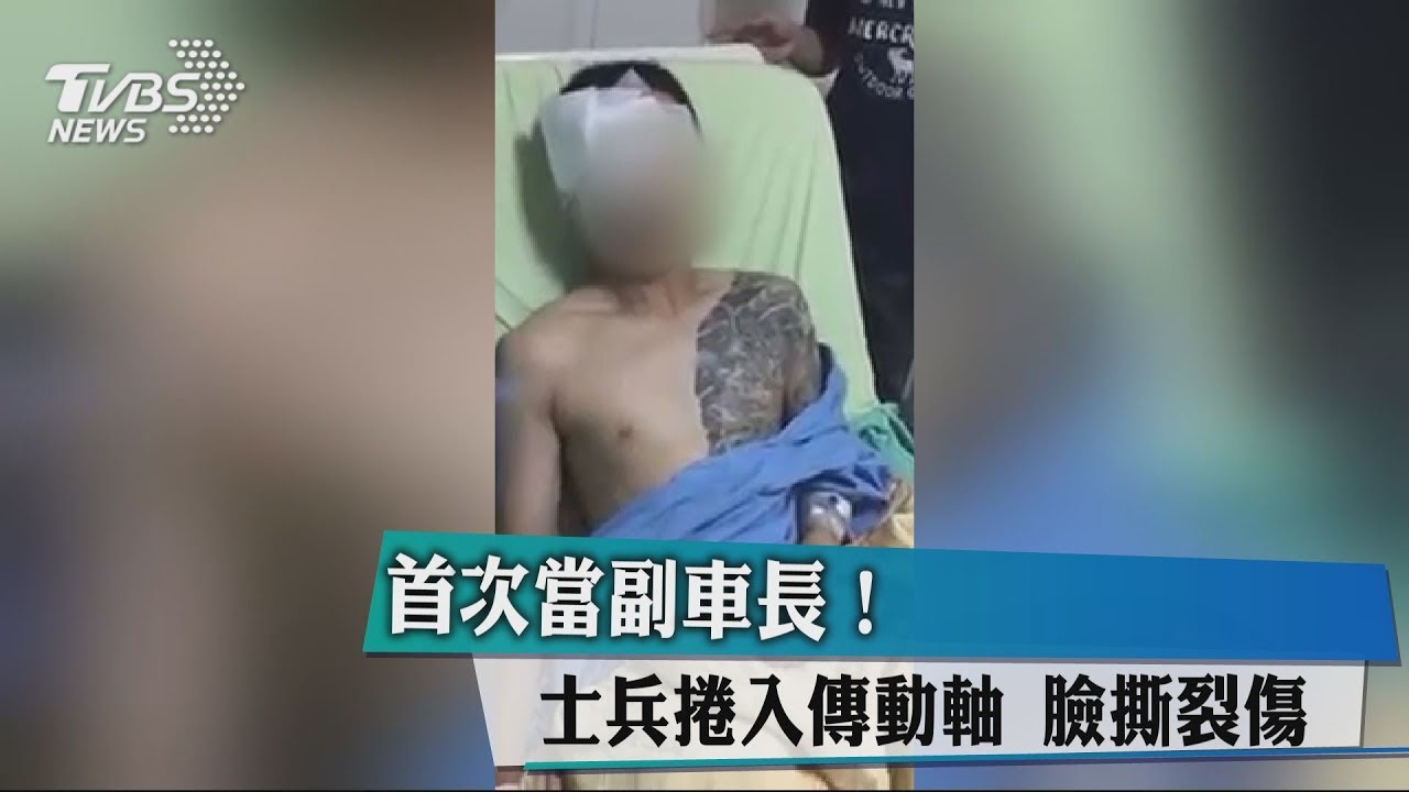 首次當副車長! 士兵捲入傳動軸臉撕裂傷