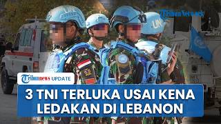 3 Prajurit TNI Terkena Ledakan di Fasilitas PBB Lebanon! 2 Terluka Parah, Penyerang Masih Misterius