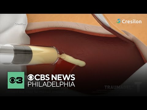 重度の出血を数秒で止める新しい方法をFDAが承認 (FDA clears new way to stop severe bleeding in seconds)